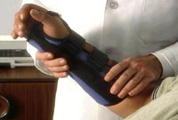 Splinting of Carpal Tunnel Syndrome